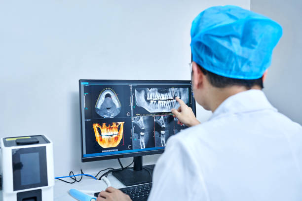 Best Emergency Dentist for Lost Fillings or Crowns in Tampa, FL